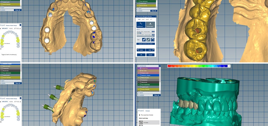 ceramill