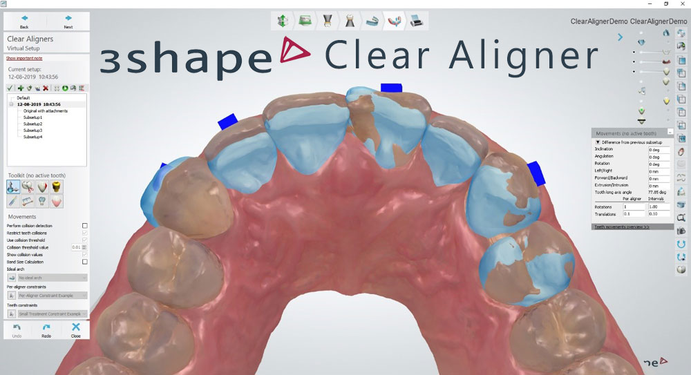 3shapeClearCligner