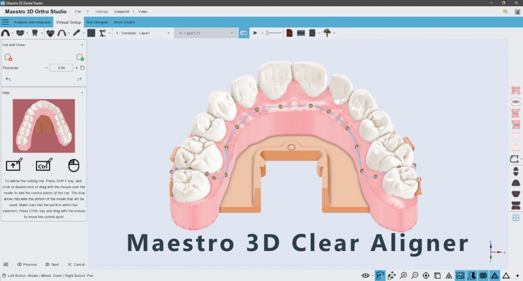maestro3d.aligner.trimming