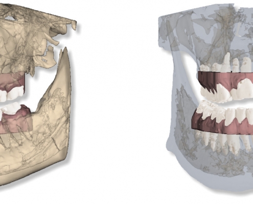 maestro3d.dental.studio.automatic.roots.bone.cbct