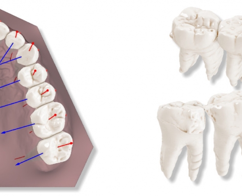 maestro3d.dental.studio.automatic.roots.cbct