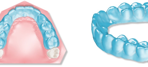 maestro3d.dental.studio.clear.aligner