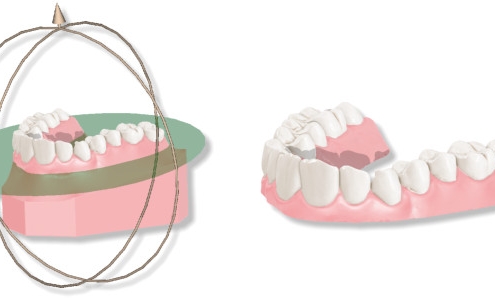 maestro3d.dental.studio.cut_and_close