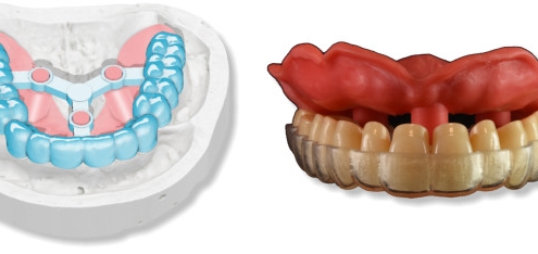 maestro3d.dental.studio.smile.creator.3D.denture.guide
