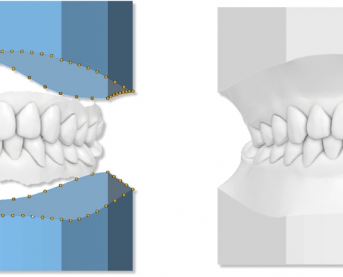 maestro3d.dental.studio.study.models