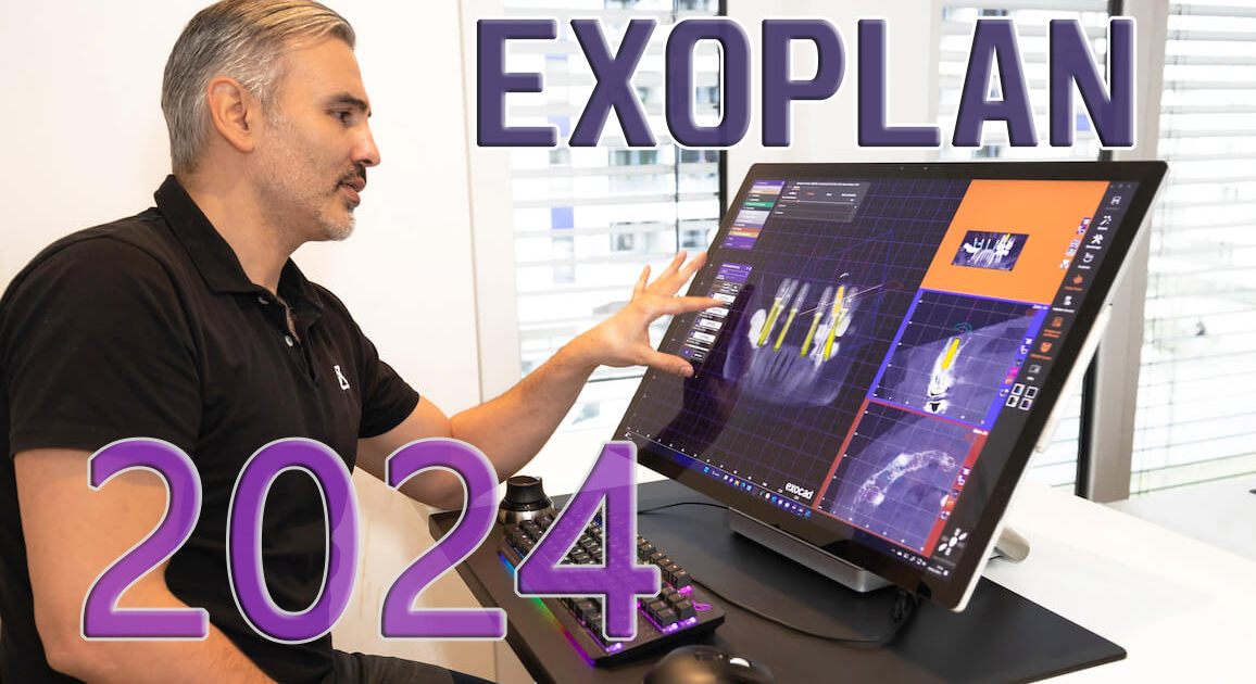 ExoPlan 2024