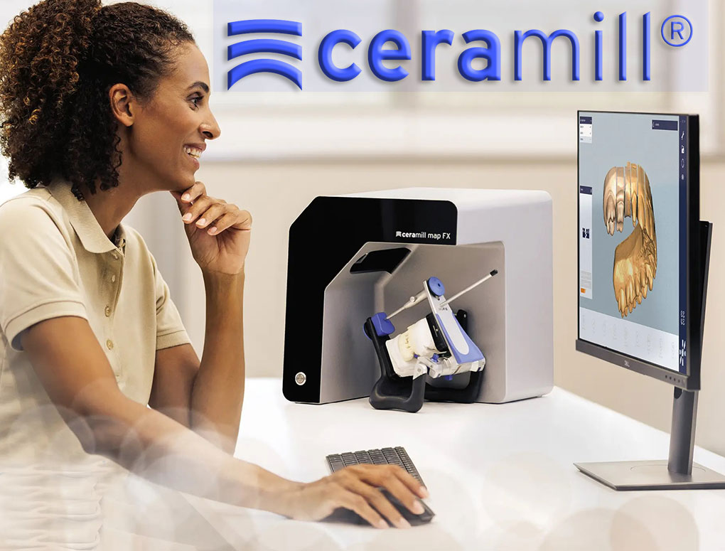 Ceramill_Mob