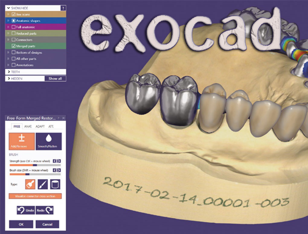 ExoCAD_mob