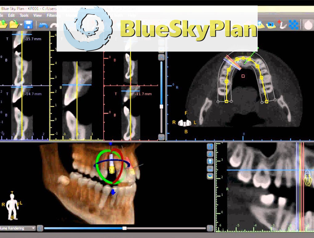 blueskyplan