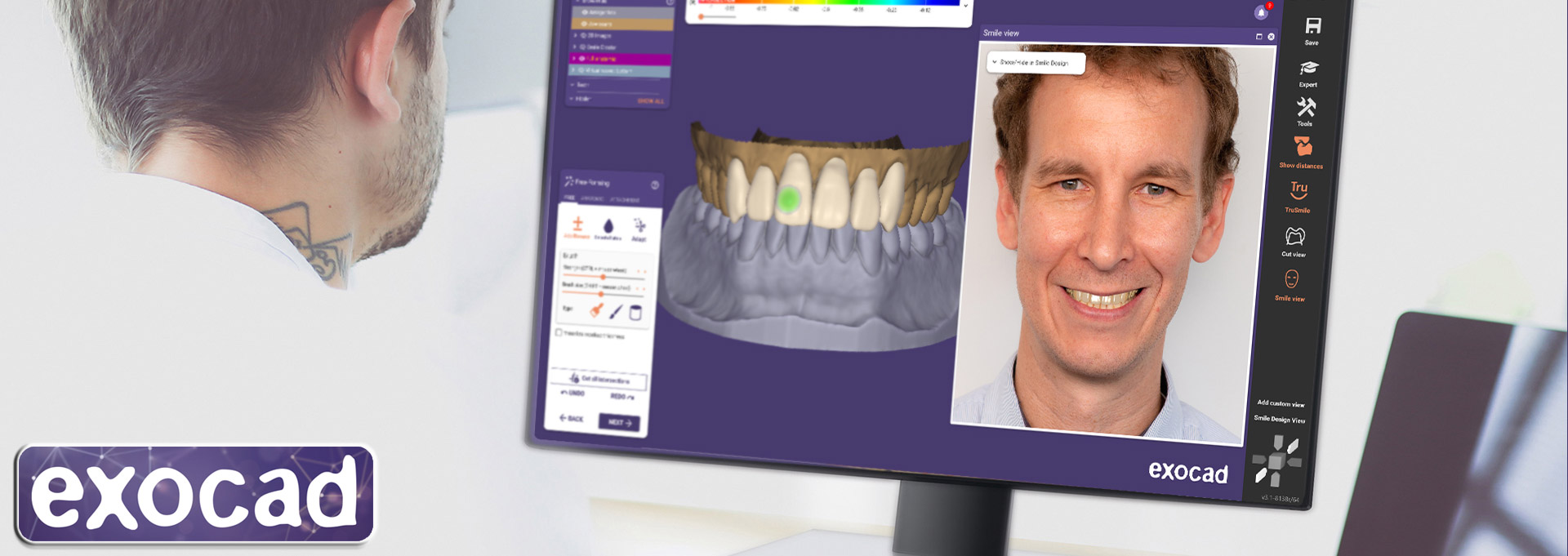 ExoCAD DentalCAD