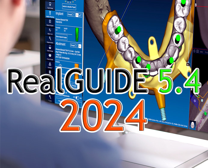 RealGUIDE 5.4 (2024): انقلاب CAD و AI در برنامه‌ریزی دندانپزشکی ...