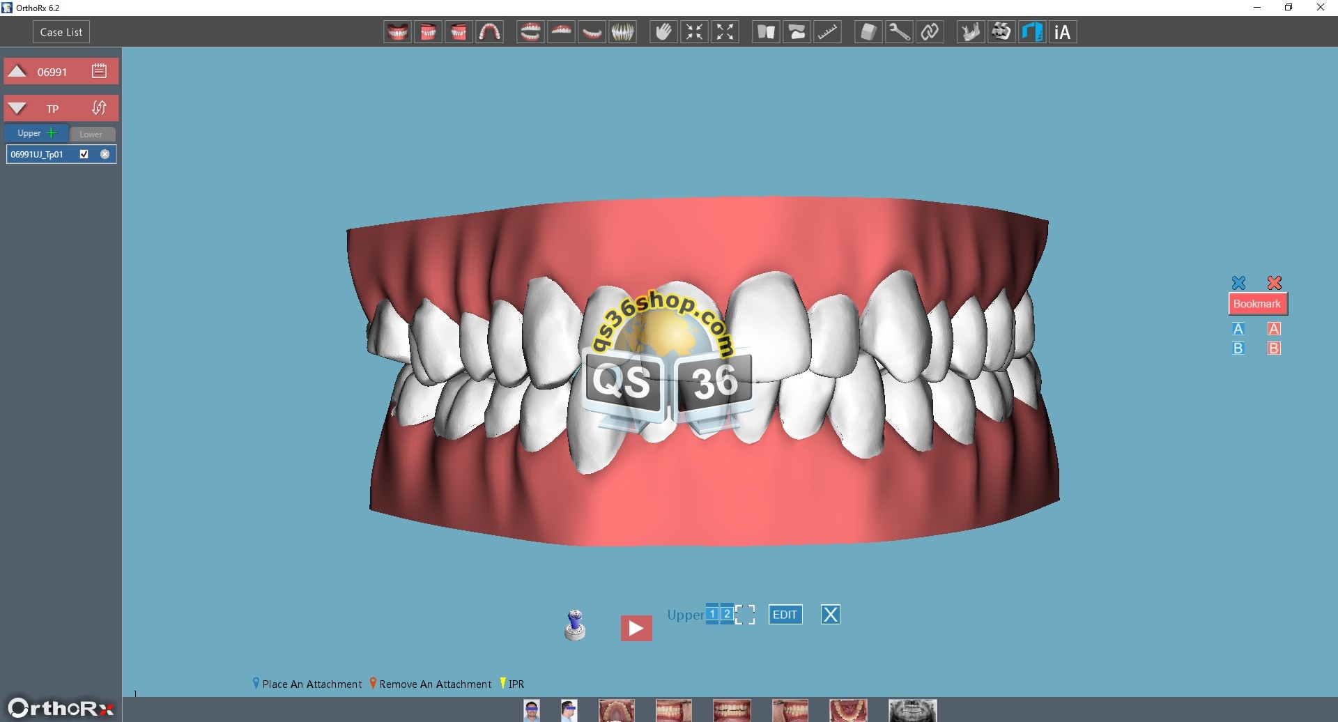 irok-orthorx-6.2-full1